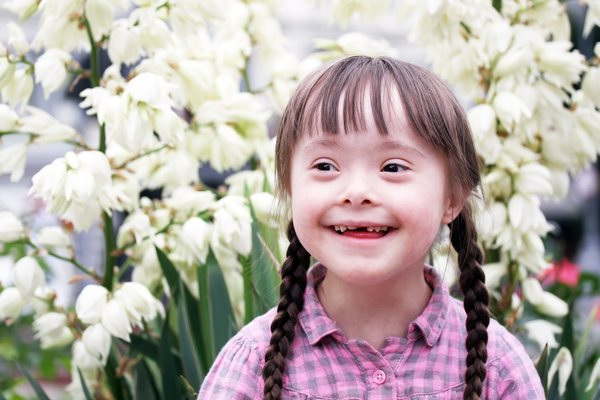 Down Syndrome image